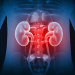 9 Visible Signs of Kidney Disease You Should Never Ignore (Doctor Explains)