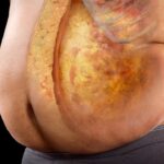 5 Science-Backed Steps to Lose Belly Fat and Keep It Off
