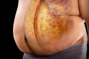Read more about the article 5 Science-Backed Steps to Lose Belly Fat and Keep It Off
